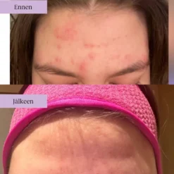 Baiobay Purifying Mask syväpuhdistava kasvonaamio 60ml