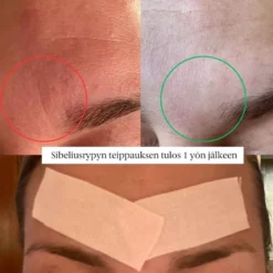 Faceimage kinesioteippi herkälle iholle, 2 eri kokoa