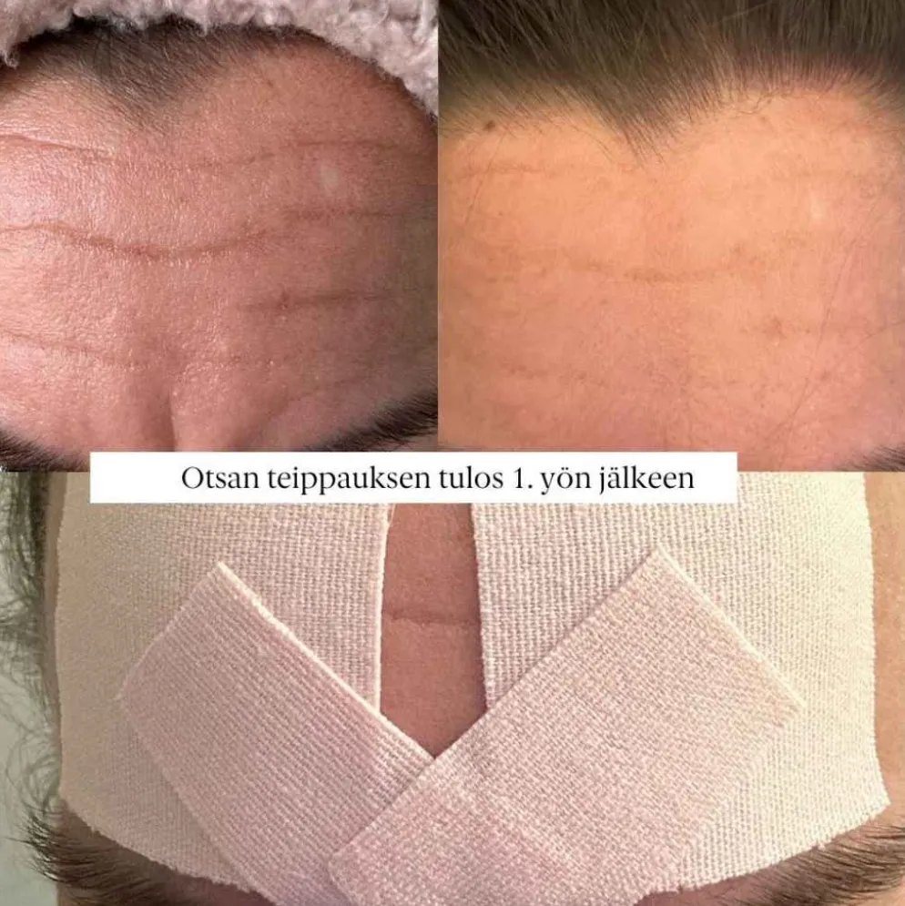 Faceimage kinesioteippi kasvoille Regular, 2 eri kokoa