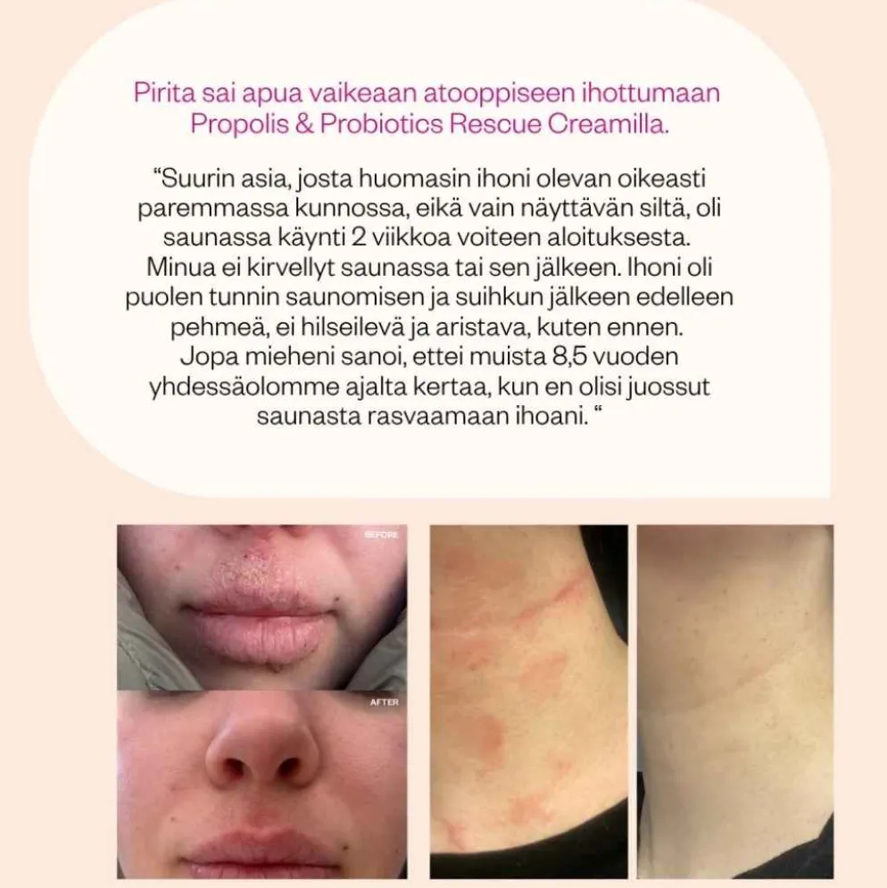 Flow Cosmetics Propolis & Probiotics Rescue Cream, 2 kokoa