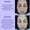 Kosteuttava kasvovesi NUORI Vital Unifier, 2 kokoa