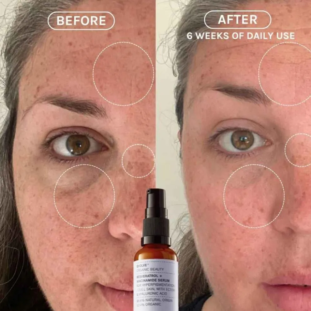 Niasiiniamidi seerumi Evolve Resveratrol + Niacinamide Serum, 2 kokoa