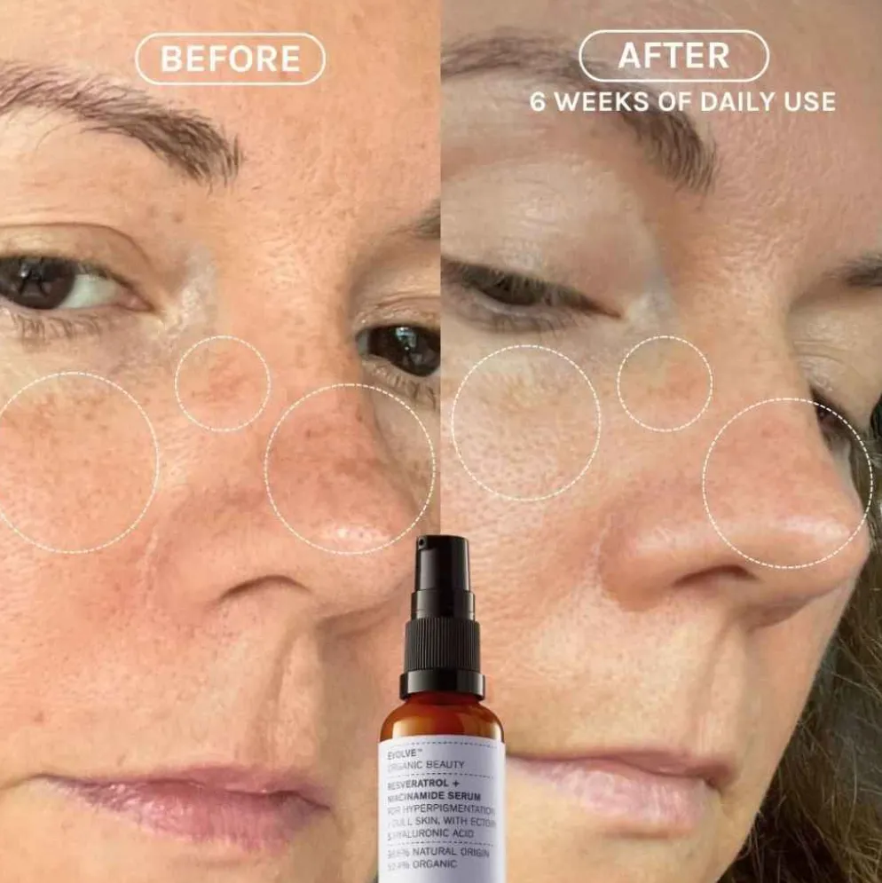 Niasiiniamidi seerumi Evolve Resveratrol + Niacinamide Serum, 2 kokoa