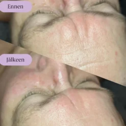 Yin Your Skin® Pro Gua Sha kasvohoito 90min